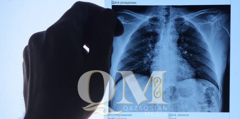 Два человека заболели эхинококкозом в СКО