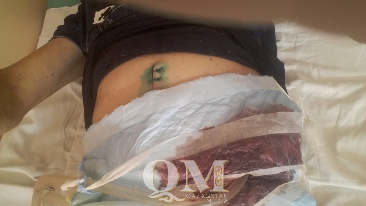 Удалили внутренние органы: в превышении полномочий подозревают полицейских в СКО