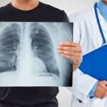 СҚО-да биыл туберкулез жұқтырғандар саны артқан