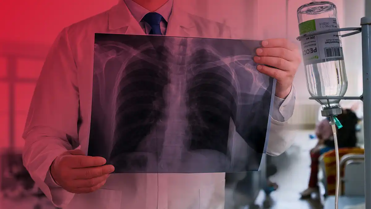 Свыше 60 млн тенге получили в виде соцподдержки больные туберкулезом в СКО