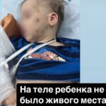 Как складывается судьба 4-летнего Славика Михеева из Петропавловска, который, якобы, упал с лестницы?