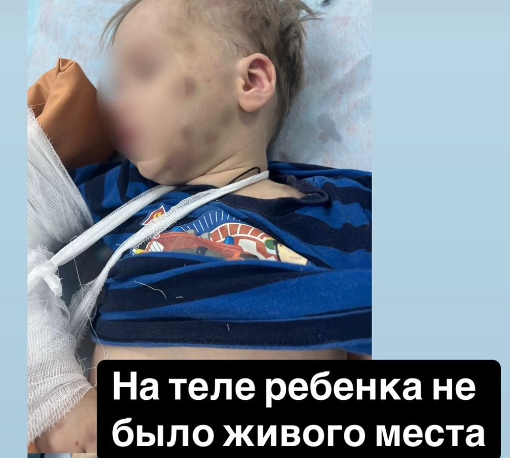 Как складывается судьба 4-летенего Славика Михеева из Петропавловска, который якобы упал с лестницы?