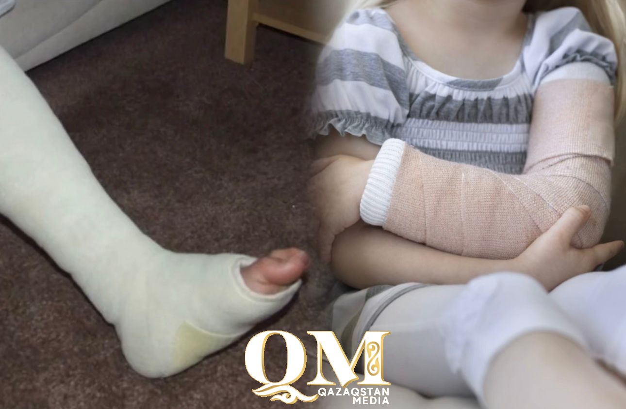 СҚО-да жыл басынан 2857 бала дене жарақатын алған