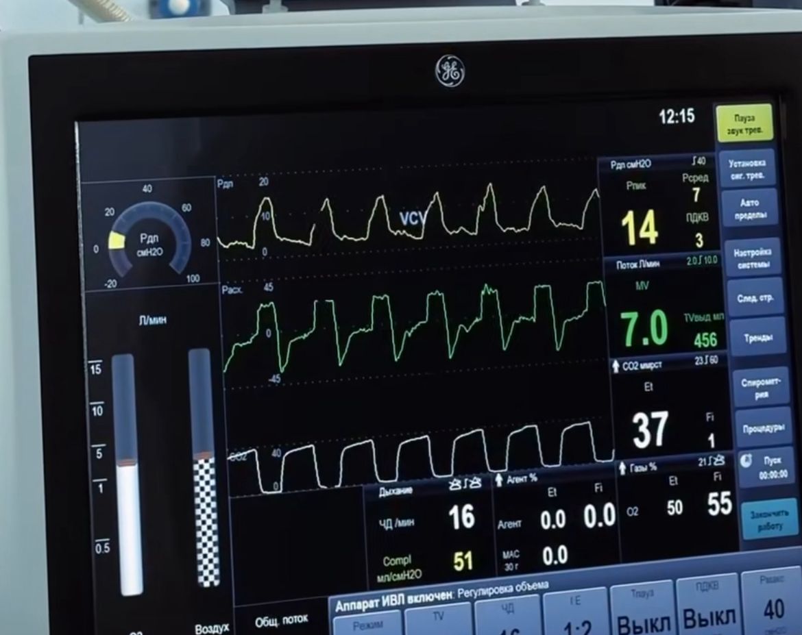 Вытащили с того света. Мужчину после аварии спасли врачи в Петропавловске
