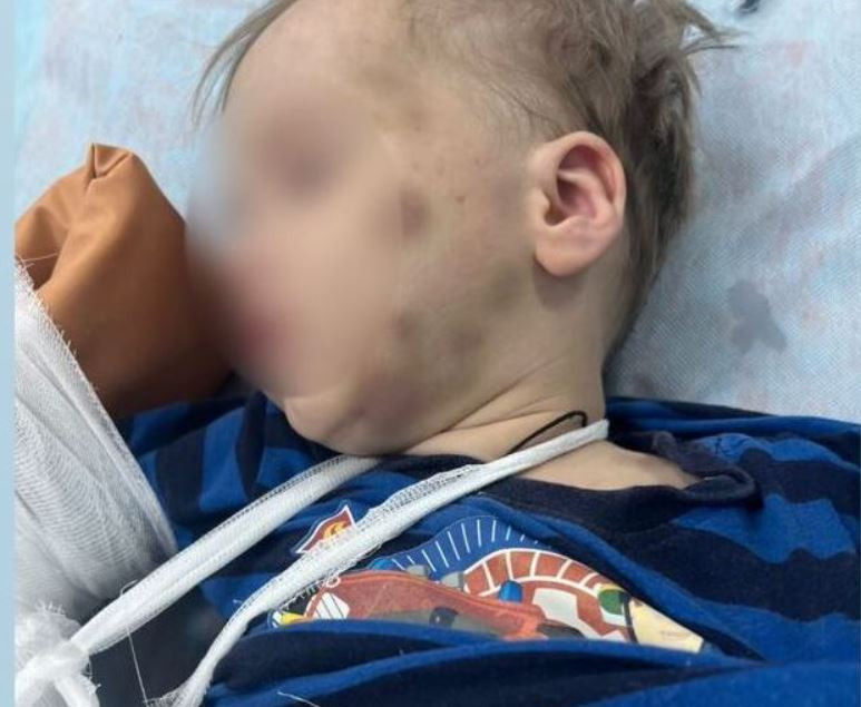 Дело без виновных: за изувеченного ребенка в Петропавловске никто не понес наказания