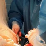 После футбола на операционный стол – врачи Петропавловска спасли спортсмену руку